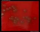 Streptococcus pneumoniae